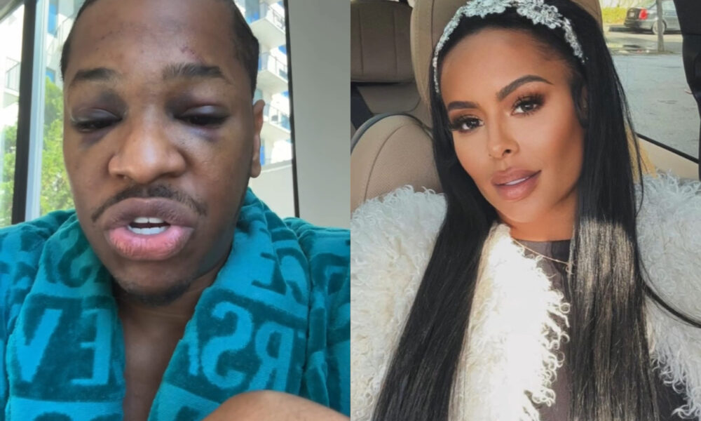 Alexis Sky Accused Of Assaulting Her Former Best Friend Anthony